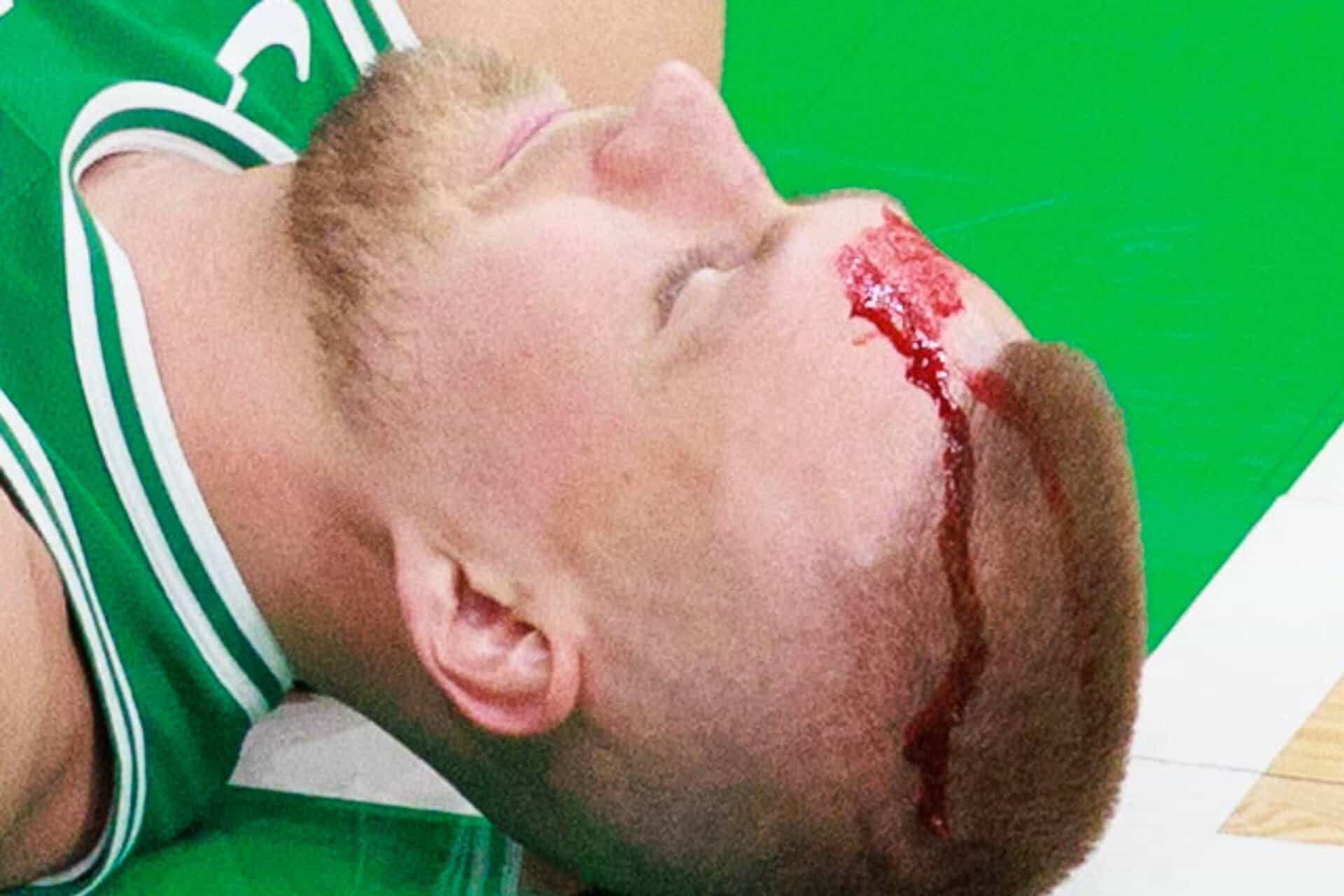 Celtics triomphent malgré la blessure sanglante de Porzingis